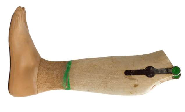 One prosthetic limb left at Sydney Airport, never reunited with its owner.